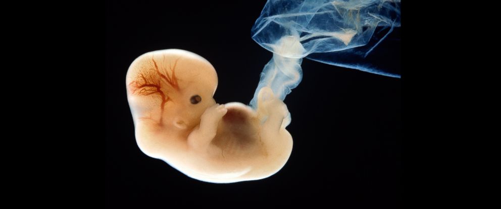 embryo